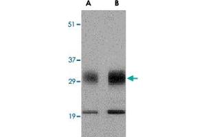 Western blot analysis of SCO1 in human brain tissue lysate with SCO1 polyclonal antibody  at (A) 0.