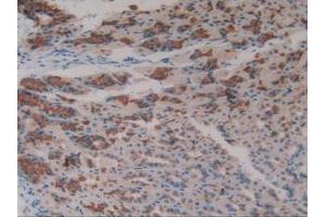 IHC-P analysis of Mouse Stomach Tissue, with DAB staining. (Asialoglycoprotein Receptor 1 Antikörper  (AA 80-281))