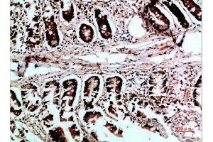 Immunohistochemistry (IHC) image for anti-Von Hippel-Lindau Tumor Suppressor, E3 Ubiquitin Protein Ligase (VHL) (AA 1-50) antibody (ABIN7189407)