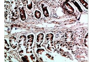 Immunohistochemical analysis of paraffin-embedded human-colon, antibody was diluted at 1:200