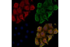 ABIN6257828 and ABIN6275878 staining Hela cells by IF/ICC.