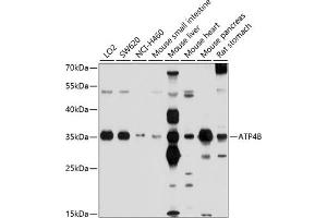 Western blot analysis of extracts of various cell lines, using B antibody (ABIN6130981, ABIN6137322, ABIN6137323 and ABIN6214233) at 1:1000 dilution.