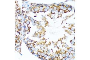 Immunohistochemistry of paraffin-embedded rat testis using STIP1 Rabbit mAb (ABIN1512566, ABIN3020619, ABIN3020620 and ABIN7101303) at dilution of 1:100 (40x lens). (STIP1 Antikörper)
