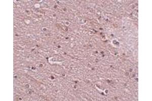 Immunohistochemistry (IHC) image for anti-Anoctamin 2 (ANO2) (N-Term) antibody (ABIN1031629) (Anoctamin 2 Antikörper  (N-Term))