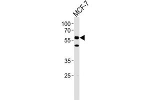 Western Blotting (WB) image for anti-Cell Division Cycle 7 (CDC7) antibody (ABIN3003260) (CDC7 Antikörper)
