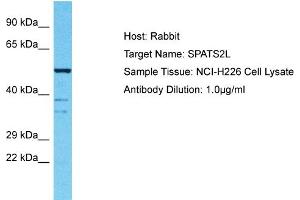Host: Rabbit Target Name: SPATS2L Sample Tissue: Human NCI-H226 Whole Cell Antibody Dilution: 1ug/ml (SPATS2L Antikörper  (N-Term))