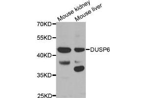 Western blot analysis of extracts of various tissues, using DUSP6 antibody. (DUSP6 Antikörper  (AA 1-170))