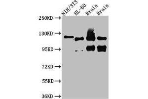 Western Blot Positive WB detected in: NIH/3T3 whole cell lysate, HL-60 whole cell lysate, Rat Brain whole cell lysate, Mouse Brain whole cell lysate All lanes: OGT antibody at 1:1000 Secondary Goat polyclonal to rabbit IgG at 1/50000 dilution Predicted band size: 117, 104, 116, 75 kDa Observed band size: 117 kDa (Rekombinanter OGT Antikörper)