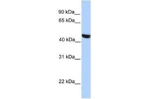 Western Blot showing MSL3L2 antibody used at a concentration of 1-2 ug/ml to detect its target protein. (MSL3L2 Antikörper  (Middle Region))