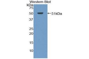 Western Blotting (WB) image for anti-Tumor Necrosis Factor Receptor Superfamily, Member 13C (TNFRSF13C) (AA 3-175) antibody (ABIN3208905) (TNFRSF13C Antikörper  (AA 3-175))