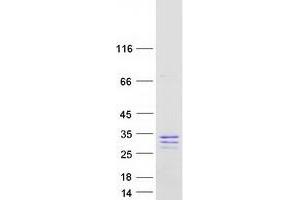 Western Blotting (WB) image for Secretogranin V (7B2 Protein) (SCG5) (Transcript Variant 1) protein (Myc-DYKDDDDK Tag) (ABIN2731597)