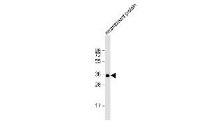 Anti-BRCA2 Antibody at 1:2000 dilution + recombinant protein Lysates/proteins at 20 μg per lane.