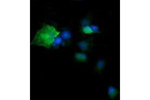 Image no. 4 for anti-Deleted in Primary Ciliary Dyskinesia Homolog (DPCD) antibody (ABIN1497889) (DPCD Antikörper)