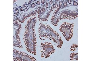 IHC analysis of DDR1 using anti-DDR1 antibody (ABIN7601407). (DDR1 Antikörper  (AA 341-909))