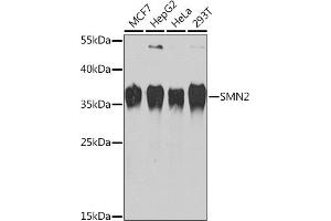 Western blot analysis of extracts of various cell lines, using SMN2 Rabbit pAb (ABIN6127949, ABIN6148136, ABIN6148139 and ABIN6218739) at 1:1000 dilution. (SMN2 Antikörper  (AA 1-197))