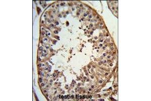 Formalin-fixed and paraffin-embedded human testis tissue reacted with ANGEL1 Antibody , which was peroxidase-conjugated to the secondary antibody, followed by DAB staining. (ANGEL1 Antikörper  (C-Term))