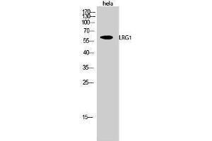 Western Blotting (WB) image for anti-Leucine-Rich alpha-2 Glycoprotein 1 (LRG1) (C-Term) antibody (ABIN3185409) (LRG1 Antikörper  (C-Term))