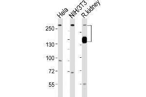 All lanes : Anti-SPTAN1 Antibody (Center) at 1:1000 dilution Lane 1: Hela whole cell lysates Lane 2: NIH/3T3 whole cell lysates Lane 3: rat kidney lysates Lysates/proteins at 20 μg per lane. (SPTAN1 Antikörper  (AA 977-991))