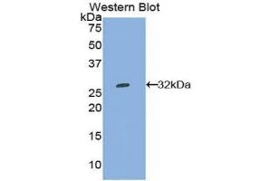 Western Blotting (WB) image for anti-Tryptophanyl-tRNA Synthetase (WARS) (AA 247-458) antibody (ABIN1860957)
