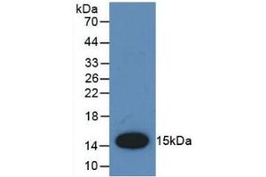 Detection of Recombinant MCP1, Rat using Polyclonal Antibody to Monocyte Chemotactic Protein 1 (MCP1) (CCL2 Antikörper  (AA 24-148))