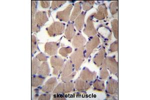 CS2 Antibody (C-term) (ABIN657066 and ABIN2846230) immunohistochemistry analysis in formalin fixed and raffin embedded human skeletal muscle followed by peroxidase conjugation of the secondary antibody and DAB staining.