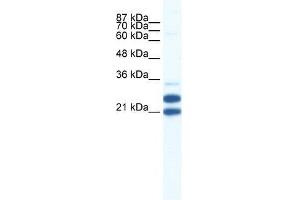 TRIM34 antibody used at 0. (TRIM34 Antikörper  (N-Term))