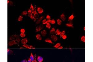 Immunofluorescence analysis of HeLa cells using NFE2L1 Polyclonal Antibody at dilution of 1:100. (NFE2L1 Antikörper)