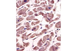 Antibody staining SPHK1 in human heart tissue sections by Immunohistochemistry (IHC-P - paraformaldehyde-fixed, paraffin-embedded sections). (SPHK1 Antikörper  (AA 286-315))