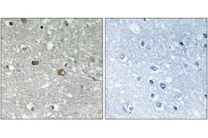 Immunohistochemistry analysis of paraffin-embedded human brain tissue, using PIGH Antibody. (PIGH Antikörper  (AA 137-186))