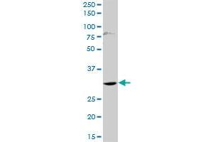 HOXD1 MaxPab rabbit polyclonal antibody. (HOXD1 Antikörper  (AA 1-328))