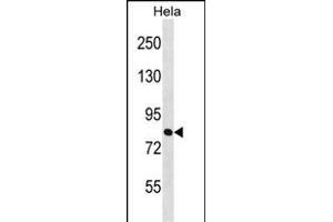 ZN Antibody (Center) (ABIN1538066 and ABIN2848974) western blot analysis in Hela cell line lysates (35 μg/lane). (ZNF131 Antikörper  (AA 205-233))