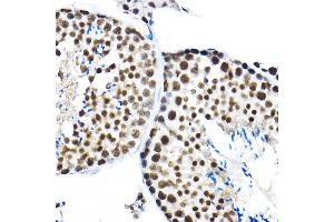 Immunohistochemistry (IHC) image for anti-Splicing Factor 3a, Subunit 3, 60kDa (SF3A3) (AA 292-501) antibody (ABIN1682671)