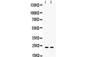 Western Blotting (WB) image for anti-Insulin-Like Growth Factor Binding Protein 5 (IGFBP5) (AA 76-114), (N-Term) antibody (ABIN3042733)