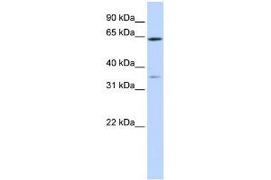 WB Suggested Anti-TRIM45 Antibody Titration:  0.