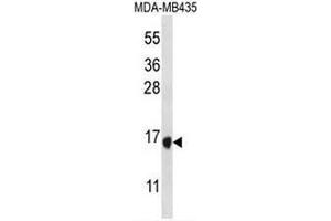 TAC4 Antibody (C-term) western blot analysis in MDA-MB435 cell line lysates (35µg/lane). (Tachykinin 4 Antikörper  (C-Term))