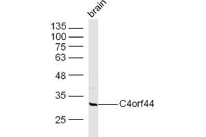 Mouse Brain lysates probed with C4orf44 Polyclonal Antibody, Unconjugated  at 1:300 overnight at 4˚C.