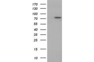 Western Blotting (WB) image for anti-Protein tyrosine Phosphatase, Receptor Type, E (PTPRE) antibody (ABIN1500507)