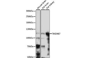Western blot analysis of extracts of various cell lines, using TMEM67 antibody (ABIN7270970) at 1:1000 dilution. (TMEM67 Antikörper  (AA 780-940))