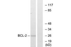 Western blot analysis of extracts from MCF7 cells, treated with Etoposide, using BCL-2 (Ab-56) Antibody. (Bcl-2 Antikörper  (AA 26-75))