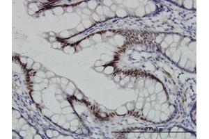 Image no. 1 for anti-Transcription Factor 7-Like 2 (T-Cell Specific, HMG-Box) (TCF7L2) (AA 490-597) antibody (ABIN466104) (TCF7L2 Antikörper  (AA 490-597))