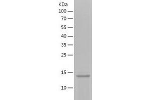 Western Blotting (WB) image for KiSS-1 Metastasis-Suppressor (KISS1) (AA 20-110) protein (His tag) (ABIN7123691) (KISS1 Protein (AA 20-110) (His tag))