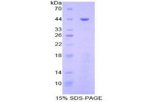 SDS-PAGE analysis of Human Golgi Protein 73 Protein. (GOLM1 Protein)
