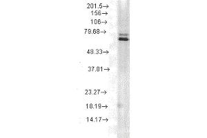 Western Blot analysis of Rat skeletal muscle tissue lysate showing detection of Hsp70 protein using Mouse Anti-Hsp70 Monoclonal Antibody, Clone 5A5 . (HSP70 Antikörper  (HRP))