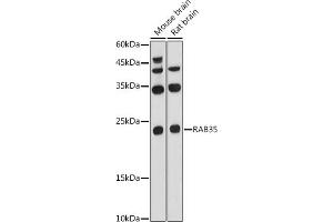 Western blot analysis of extracts of various cell lines, using R antibody (ABIN6133143, ABIN6146576, ABIN6146578 and ABIN6224057) at 1:1000 dilution. (RAB35 Antikörper  (AA 1-201))
