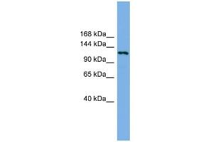Western Blotting (WB) image for anti-Eukaryotic Translation Initiation Factor 4E Nuclear Import Factor 1 (EIF4ENIF1) (N-Term) antibody (ABIN2787180)