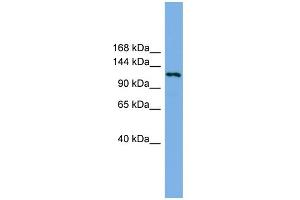 WB Suggested Anti-EIF4ENIF1 Antibody Titration: 0.