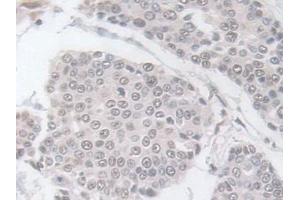 Immunohistochemistry (IHC) image for anti-Glutathione Peroxidase 3 (Plasma) (GPX3) (AA 21-72) antibody (ABIN7435298)