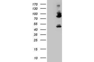 Image no. 3 for anti-Coagulation Factor XIII, A1 Polypeptide (F13A1) antibody (ABIN1498152) (F13A1 Antikörper)