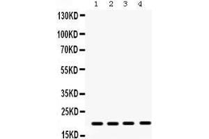 Western Blotting (WB) image for anti-Non-Metastatic Cells 1, Protein (NM23A) Expressed in (NME1) (AA 26-58), (N-Term) antibody (ABIN3043572)