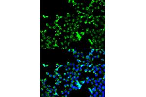 Immunofluorescence analysis of A549 cell using CALR antibody. (Calreticulin Antikörper)